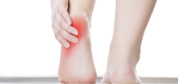 Plantar Fasciitis